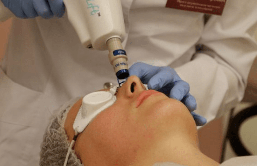 Neprejateľné laserové omladenie